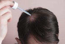 hair-implants-cost-in-2025-–-what-you-should-expect-to-pay
