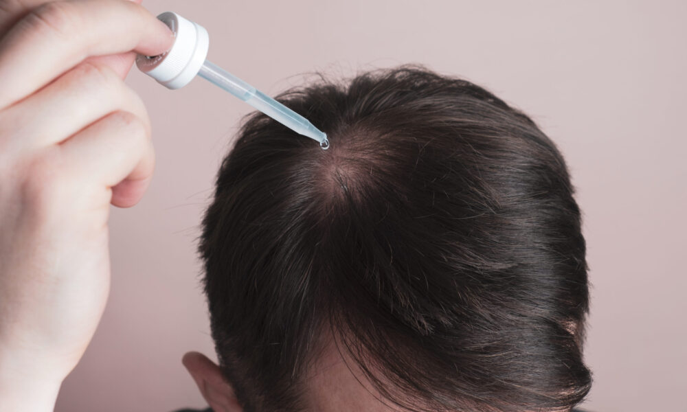 hair-implants-cost-in-2025-–-what-you-should-expect-to-pay